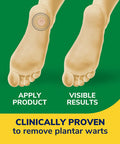 Dr. Scholl's Clear Away Wart Remover Maximum Strength, Plantar for Feet - 24 ct