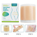 Silicone Scar Sheets - (1.6 X 60 ) Professional Scar Removal Sheets For C-Section, Burn, Acne - Soft Silicone Gel Scar Tape
