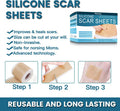 Silicone Scar Sheets (2 Rolls), Medical Grade Silicone Scar Tape, Scar Removal Strips For Acne, Burn Scars C-Section & Keloid Surgery Scars Sheets Treatment Sheets - 8 Month Supply