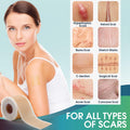 Professional Silicone Scar Sheets (1.6" X 150" Scar Roll-3.8M) - Scars Removal Treatment - Reusable Silicone Scar Tape Strips Type For Keloid, C-Section, Surgery, Burn, Acne Et
