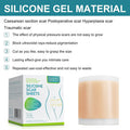 Silicone Scar Sheets - (1.6 X 60 ) Professional Scar Removal Sheets For C-Section, Burn, Acne - Soft Silicone Gel Scar Tape