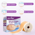Silicone Scar Tape For Scar Treatment, Advanced Scar Removal Sheets, Soften And Flattens Old Scars And Scars Which Resulting From Surgery, Acne, Injury, Burns, C-Section And More (1.6 X 60 )