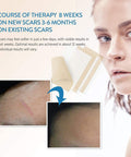 Aroamas Scar Silicone Scar Tape Softens and Flattens Scars From Surgery, Injury, Burns, C-Section, Scratch Marks Reusable Medical-Grade Silicone Scar Sheets For All Skin Types 3"X1.57", 8 Sheets