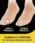 Dr. Scholl's Duragel ClearAway Wart Remover Kit 1 ea