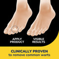 Dr. Scholl's Duragel ClearAway Wart Remover Kit 1 ea