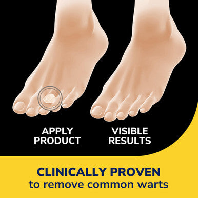 Dr. Scholl's Duragel ClearAway Wart Remover Kit 1 ea