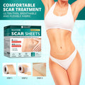 Silicone Scar Sheets,Silicone Scar Tape(1.6"X 60" Roll-1.5M), Reusable And Effective Scar Removal Sheets, Silicone Scar Removal Sheets For Surgical Scars,Healing Keloid, C-Section, Tummy Tuck