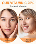 Elbbub Premium 20% Vitamin C Serum For Face with Hyaluronic Acid Retinol & Amino Acids - Boost Skin CollagenHydrate & Plump Skin Anti Aging & Wrinkle Facial Serum 60ml
