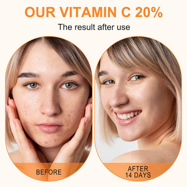 Elbbub Premium 20% Vitamin C Serum For Face with Hyaluronic Acid Retinol & Amino Acids - Boost Skin CollagenHydrate & Plump Skin Anti Aging & Wrinkle Facial Serum 60ml