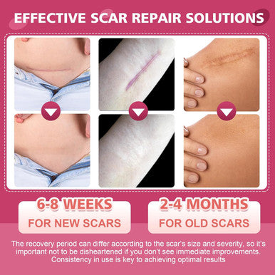Silicone Scar Sheets,Silicone Scar Tape,Scar Tape For Surgical Scars,C-Section,Tummy Tuck,Keloid Bump Removal (1.6"X 59" Roll-1.5M-Pigment Reduction Enhanced Version-Pink)