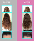 Upnourish Hair Growth Vitamins For Women - Proven Hair Supplement With Keranat, Dht Blocker Phytopin, Biotin 5000 Mcg & Sod, Hair Vitamins For Faster Hair Growth, Hair Loss & Thinning Hair - 90 Ct