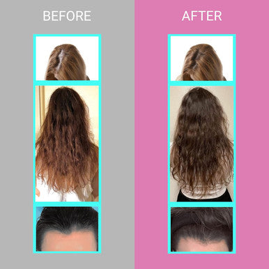 Upnourish Hair Growth Vitamins For Women - Proven Hair Supplement With Keranat, Dht Blocker Phytopin, Biotin 5000 Mcg & Sod, Hair Vitamins For Faster Hair Growth, Hair Loss & Thinning Hair - 90 Ct