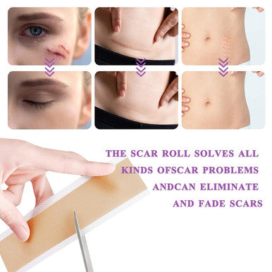 Silicone Scar Tape Roll, 1.6 X 60 Medical Tape For Wound Care Bandages Scars Strips For Surgical Scars Keloid, C-Section, Burns, Injuries Acne, Stretch Marks Removal Sheet Tapes (1.6 X 60 )