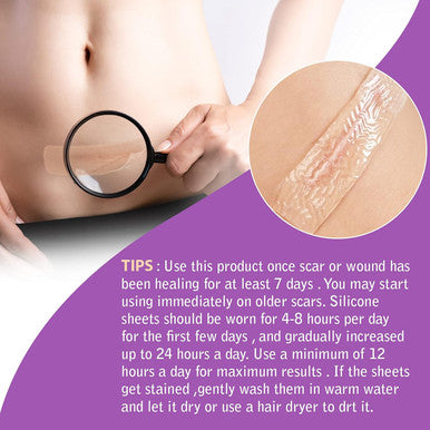 Silicone Scar Tape Roll, 1.6 X 60 Medical Tape For Wound Care Bandages Scars Strips For Surgical Scars Keloid, C-Section, Burns, Injuries Acne, Stretch Marks Removal Sheet Tapes (1.6 X 60 )