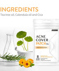 Avarelle Pimple Patches Hydrocolloid Acne Patches, Acne Spot Treatment for Blemishes and Zit with Tea Tree Oil, Calendula Oil and Cica Oil for Face, Vegan, Cruelty Free (8CT XL + Frontline Support)