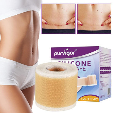 Silicone Scar Tape Roll, 1.6 X 60 Medical Tape For Wound Care Bandages Scars Strips For Surgical Scars Keloid, C-Section, Burns, Injuries Acne, Stretch Marks Removal Sheet Tapes (1.6 X 60 )