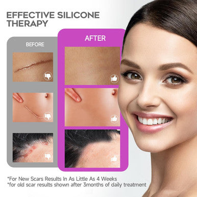 Advanced Scar Cream, 1.7 Oz(50Ml) Large Capacity, Silicone Scar Gel For After Surgical, C-Section, Stretch Marks, Keloids, Burns, Effective On Old & Scars,Lavender Scent