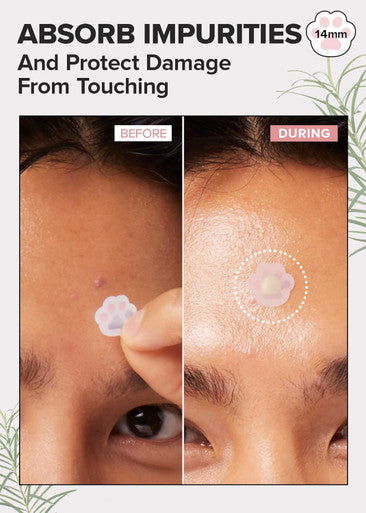 I Dew Care Hydrocolloid Acne Pimple Patch - Timeout Blemish Happy Paws + Tweezer - Tweeze The Day | Precision Stainless Steel, Professional Hair Beauty Tool Bundle