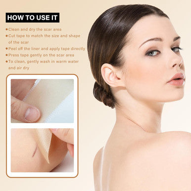 Medical Grade Silicone Scar Tape For Scars Removal - 164" X 1.57" Roll - Silicone Scar Sheets For C-Section, Tummy Tuck, Keloid, And Surgical Scars - Reusable