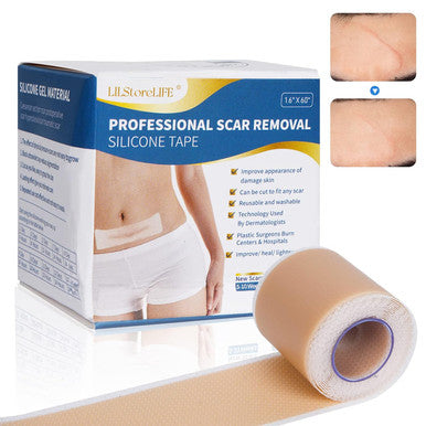 Silicone Scar Sheets, Silicone Scar Tape Roll (60 X1.6 ), Professional Scars Removal Treatment, Scar Silicone Strips, Reusable Silicone Scar Strips Type For Keloid, C-Section, Surgery, Keloid, Acne
