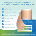 Silicone Scar Sheets, Medical Grade Silicone Scar Tape, Reusable Scar Removal Strips For Surgical Scars, C-Section, Keloid, Tummy Tuck, Burn, Acne, Surgery Scars Treatment