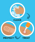 Band-Aid Brand Tru-Stay Clear Spots Bandages for Discreet First Aid (All One Size) -50 Count