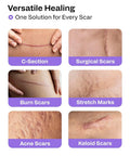 Awd Silicone Scar Sheets For Surgical Scars - Medical Grade Silicone Scar Tape For C Section, Tummy Tuck Tape, Keloid Treatment - Silicone Skin Patches After Surgery Must Haves (1.6" X 120" Roll)