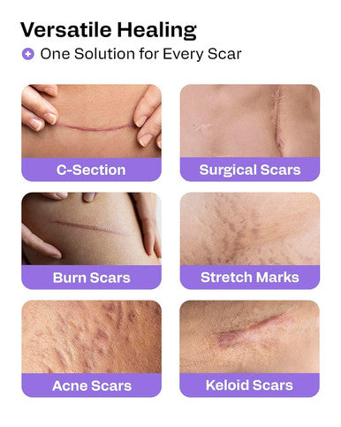 Awd Silicone Scar Sheets For Surgical Scars - Medical Grade Silicone Scar Tape For C Section, Tummy Tuck Tape, Keloid Treatment - Silicone Skin Patches After Surgery Must Haves (1.6" X 120" Roll)