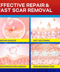 Medical Silicone Scar Tape For Scars: Medical Grade Scar Sheets Reduces The Appearance Of Scars From Surgical Acne Stitches Burns More 1.6"X 120"