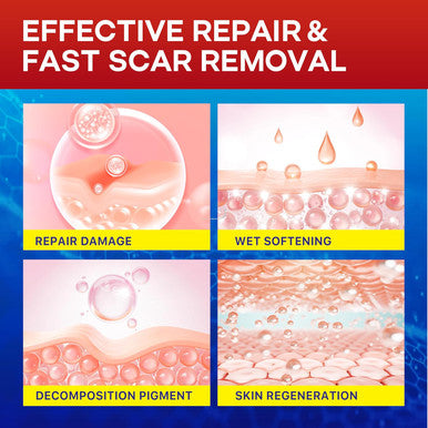 Medical Silicone Scar Tape For Scars: Medical Grade Scar Sheets Reduces The Appearance Of Scars From Surgical Acne Stitches Burns More 1.6"X 120"
