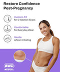 Awd Silicone Scar Sheets For Surgical Scars - Medical Grade Silicone Scar Tape For C Section, Tummy Tuck Tape, Keloid Treatment - Silicone Skin Patches After Surgery Must Haves (1.6" X 120" Roll)
