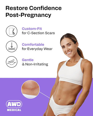 Awd Silicone Scar Sheets For Surgical Scars - Medical Grade Silicone Scar Tape For C Section, Tummy Tuck Tape, Keloid Treatment - Silicone Skin Patches After Surgery Must Haves (1.6" X 120" Roll)
