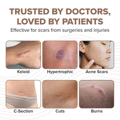 Pro-Sil Spf (Pro-Sil Sport) Patented Silicone Scar Treatment Stick W/Sunscreen (Spf 15) Clinically Proven To Reduce The Appearance Of Old & Scars Easy Glide-On Applicator, 4.25G