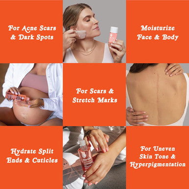 Bio-Oil Skincare Body Oil Vitamin E Serum For Scars & Stretchmarks Face & Body Moisturizer 2 Oz All Skin Types