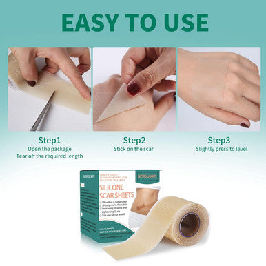 Silicone Scar Tape 1.6"X 60" Reusable Silicone Sheet For Scar Away Treatment Stretch Mark Removal Tattoo Cover Up Painless Scar Removal For Surgery, C Section, Acne, Keloid