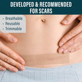 Nuvadermis Silicone Scar Tape For Surgical Scars - 120" X 1.5" Roll - Extra Long Medical Grade Silicone Scar Tape For C-Section, Tummy Tuck, Keloid, And Surgical Scars - Reusable Tape Strips - 1 Pack