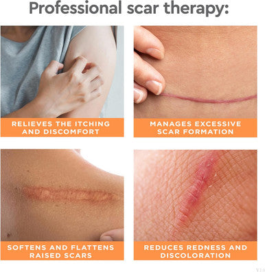 Strataderm Professional Scar Therapy Gel Old And Scars From General Surgery, Trauma, Wounds, Burns, Bites, Acne & Skin Disease Reduces Redness, Discoloration, Discomfort & Itch 5G (0.17Oz)