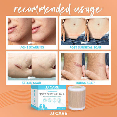 Jj Care Soft Silicone Tape, 1.6 X 120 Flexible Silicone Scar Tape, Medical Grade Silicone Strips For Scars, Washable & Reusable Scar Tape For Surgical Scars, Latex-Scar Tape