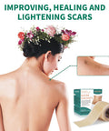 Silicone Scar Tape 1.6"X 60" Reusable Silicone Sheet For Scar Away Treatment Stretch Mark Removal Tattoo Cover Up Painless Scar Removal For Surgery, C Section, Acne, Keloid
