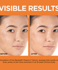 L'Oreal Paris Revitalift 12% Pure Vitamin C Serum Vitamin E Salicylic Acid Brightening 1 Oz + Moisturizer Sample