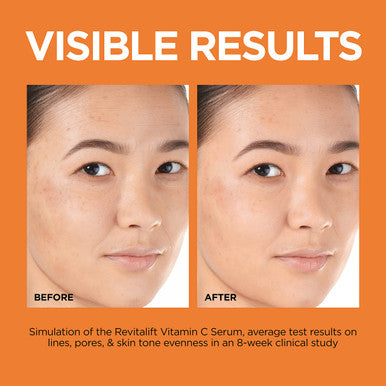 L'Oreal Paris Revitalift 12% Pure Vitamin C Serum Vitamin E Salicylic Acid Brightening 1 Oz + Moisturizer Sample