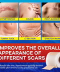 Medical Silicone Scar Tape For Scars: Medical Grade Scar Sheets Reduces The Appearance Of Scars From Surgical Acne Stitches Burns More 1.6"X 120"