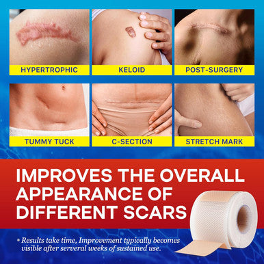 Medical Silicone Scar Tape For Scars: Medical Grade Scar Sheets Reduces The Appearance Of Scars From Surgical Acne Stitches Burns More 1.6"X 120"