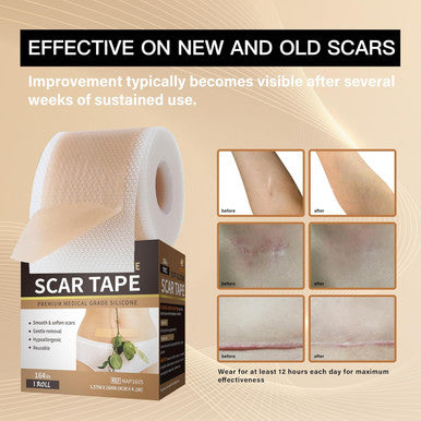 Medical Grade Silicone Scar Tape For Scars Removal - 164" X 1.57" Roll - Silicone Scar Sheets For C-Section, Tummy Tuck, Keloid, And Surgical Scars - Reusable
