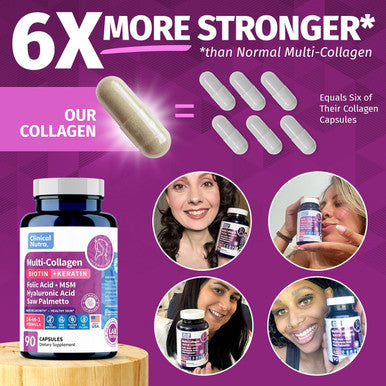 Collagen Peptides L Biotin L Keratin L Hyaluronic Acid L Saw Palmetto - Hair Growth Vitamins For Women And Men Supplement - Dht Blocker Supplements 90 Capsules Usa Made