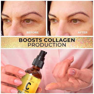 InstaSkincare Glow Effect and Post Acne Bundle Hyaluronic Acid Serum for Face 2Oz Retinol Face Serum Vitamin E and A Aloe Vera 2Oz Vitamin C Serum 2Oz