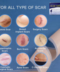 Advanced Silicone Scar Sheets Tape - Medical Grade Soft Silicone Gel Scar Sheets Tape, Highly Comfortable Painless For C-Section, Stretch Marks, Acne, Surgery, Effective Scars Treatment Tapes