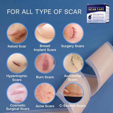Advanced Silicone Scar Sheets Tape - Medical Grade Soft Silicone Gel Scar Sheets Tape, Highly Comfortable Painless For C-Section, Stretch Marks, Acne, Surgery, Effective Scars Treatment Tapes