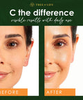 Tree of Life Vitamin C Serum for Face - Vit C Serum with Hyaluronic Acid and Vitamin E - Skin Brightening and Anti Aging Vitamin C Face Serum for Dry and Sensitive Skin, Dermatologist-Tested - 1 Fl Oz
