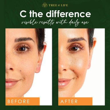 Tree of Life Vitamin C Serum for Face - Vit C Serum with Hyaluronic Acid and Vitamin E - Skin Brightening and Anti Aging Vitamin C Face Serum for Dry and Sensitive Skin, Dermatologist-Tested - 1 Fl Oz